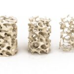 骨粗しょう症・イメージ