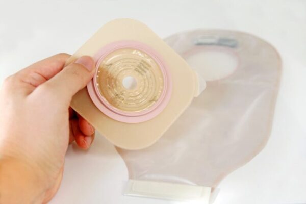 ストマ 2ピースパウチ